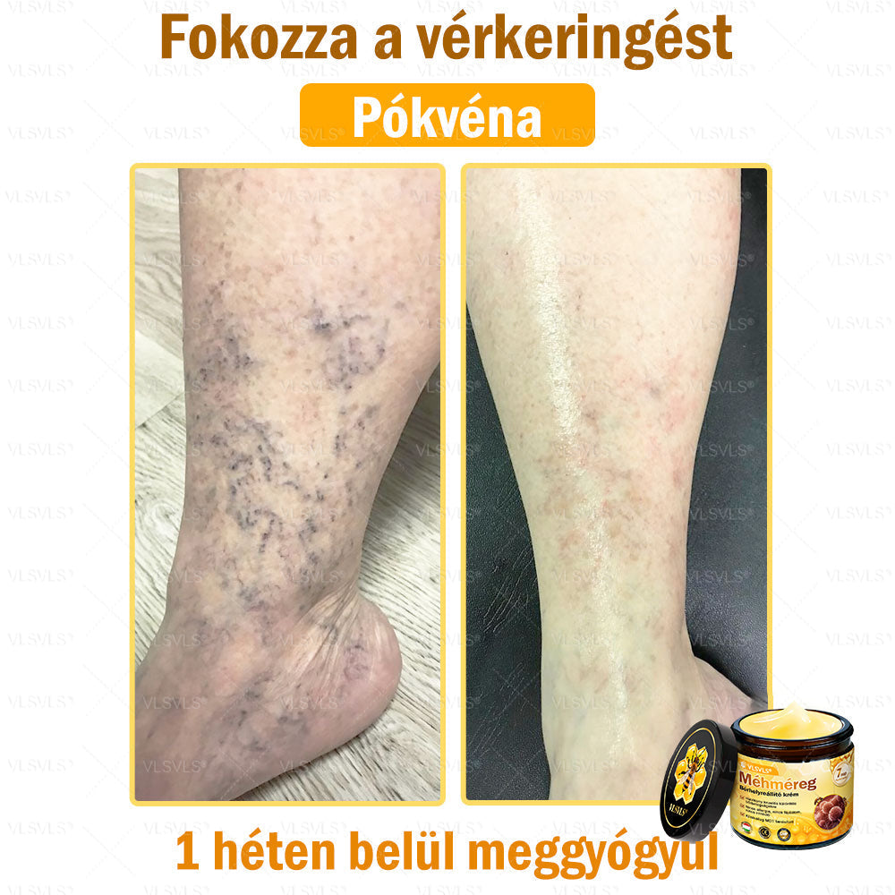 VLSVLS® Méhméreg Bőrhelyreállító Krém (👨‍⚕‍CE jóváhagyott)👍✅✅