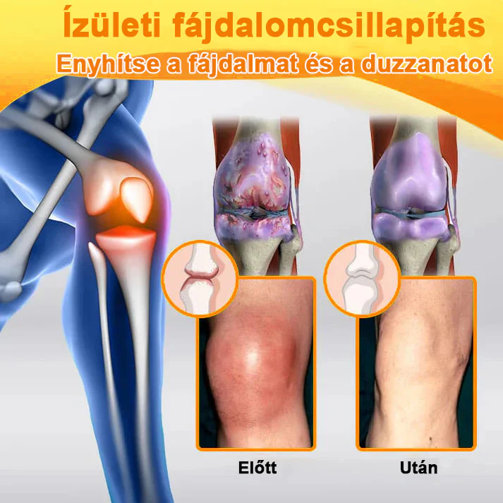 ✅ Hivatalos áruház: Ouryard™ Magnéziumolaj és Mézes Ízületjavító Spray 👨‍⚕️ Jóváhagyva a Magyar Gyógyszerészeti és Egészségügyi Minőség- és Szervezetfejlesztési Intézet (OGYÉI) által. 🔥