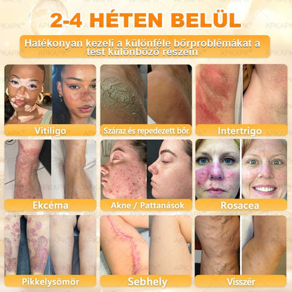 🎁🧡APKAPK®  Méhméreg krém a bőr megújítására 🐝 segít megoldani olyan bőrproblémákat, mint: ráncok, hegek, pigmentfoltok, striák, akné, pikkelysömör, ekcéma, bőrelváltozások, irritációk, gyulladások és egyéb bőrpanaszok.🧡🐝🐝