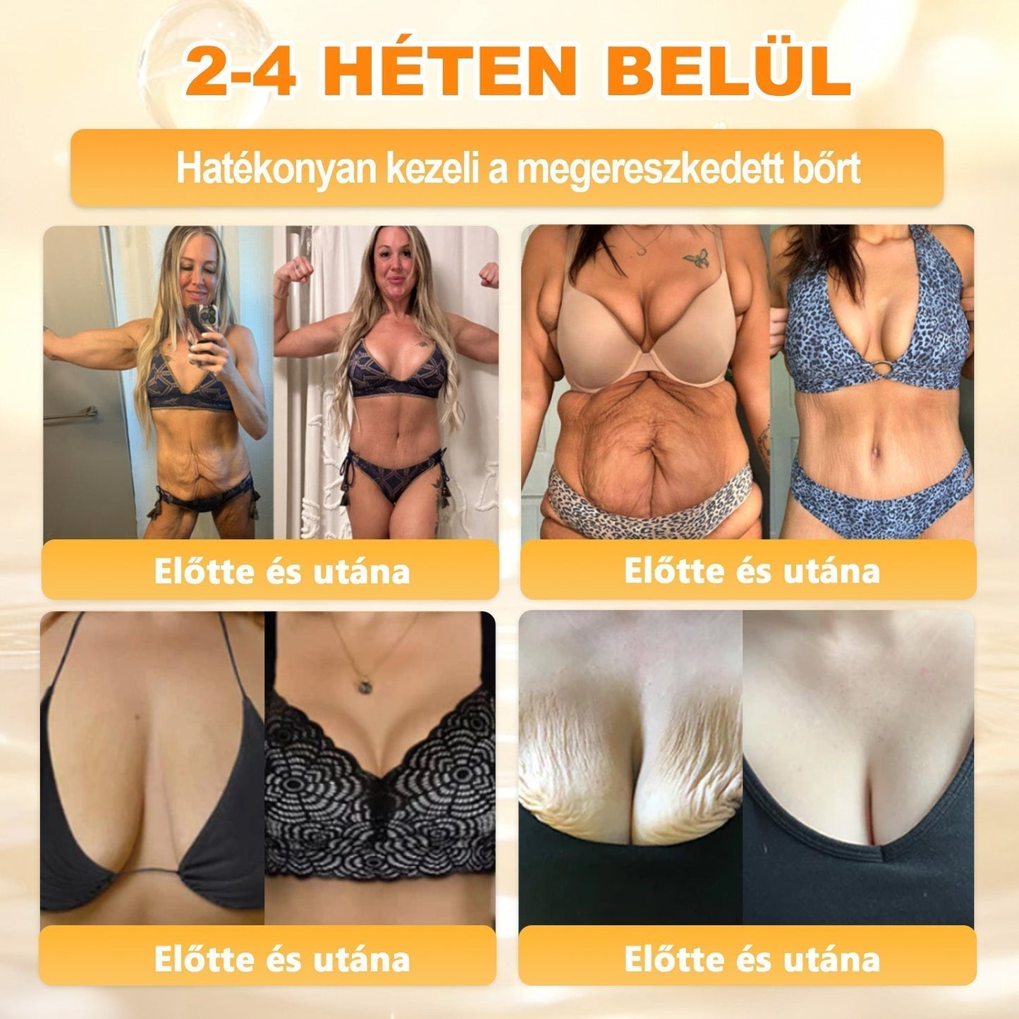 🎁🧡APKAPK®  Méhméreg krém a bőr megújítására 🐝 segít megoldani olyan bőrproblémákat, mint: ráncok, hegek, pigmentfoltok, striák, akné, pikkelysömör, ekcéma, bőrelváltozások, irritációk, gyulladások és egyéb bőrpanaszok.🧡🐝🐝