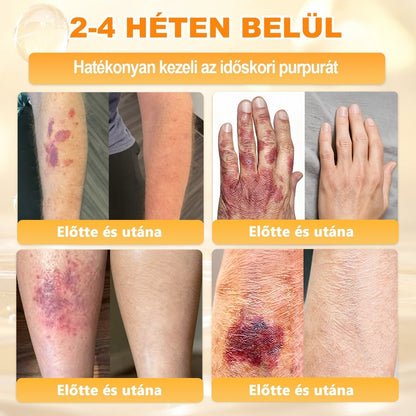 🎁🧡APKAPK®  Méhméreg krém a bőr megújítására 🐝 segít megoldani olyan bőrproblémákat, mint: ráncok, hegek, pigmentfoltok, striák, akné, pikkelysömör, ekcéma, bőrelváltozások, irritációk, gyulladások és egyéb bőrpanaszok.🧡🐝🐝