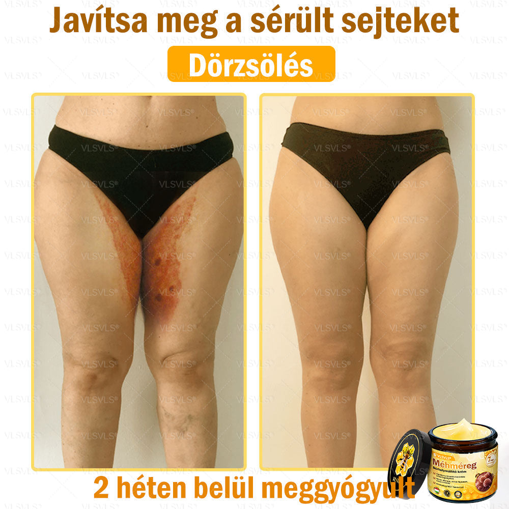 VLSVLS® Méhméreg Bőrhelyreállító Krém (👨‍⚕‍CE jóváhagyott)👍✅✅