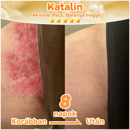 🎁🧡APKAPK®  Méhméreg krém a bőr megújítására 🐝 segít megoldani olyan bőrproblémákat, mint: ráncok, hegek, pigmentfoltok, striák, akné, pikkelysömör, ekcéma, bőrelváltozások, irritációk, gyulladások és egyéb bőrpanaszok.🧡🐝🐝