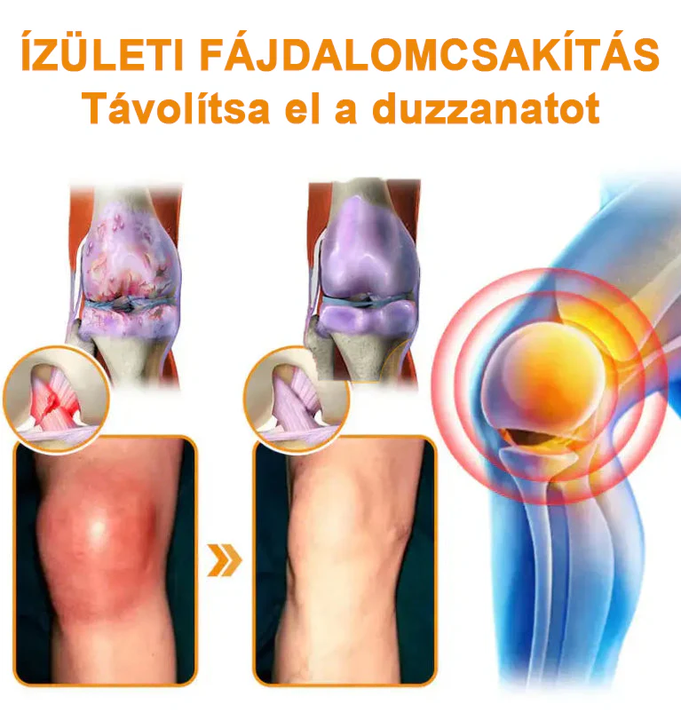 ✅ Hivatalos áruház: Ouryard™ Magnéziumolaj és Mézes Ízületjavító Spray 👨‍⚕️ Jóváhagyva a Magyar Gyógyszerészeti és Egészségügyi Minőség- és Szervezetfejlesztési Intézet (OGYÉI) által. 🔥