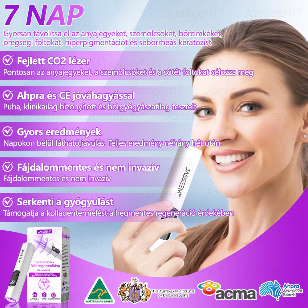 𝐉𝐚𝐬𝐬𝐞𝐞𝐦® Fejlett, nem invazív bőrjavító CO₂ lézeres toll 🛫 (Gyengéden eltávolítja a szemölcsöket, anyajegyeket, öregségi foltokat és bőrkinövéseket – fájdalom és gond nélkül!)🔥🔥