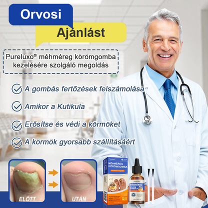 👣🐝🐝Pureluxo® Méhméreg Körömgomba Kezelőoldat: Teljes megoldás a körömgomba problémájára🌟👣👣👣👣👣