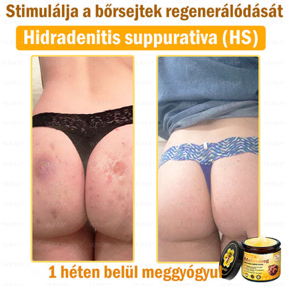 VLSVLS® Méhméreg Bőrhelyreállító Krém (👨‍⚕‍CE jóváhagyott)👍✅✅