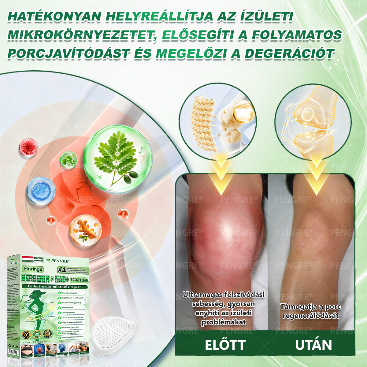 🌷𝐏𝐄𝐍𝑮𝑹𝐄® 𝗠𝗼𝗿𝗶𝗻𝗴𝗮 × 𝗕𝗲𝗿𝗯𝗲𝗿𝗶𝗻𝗲 × 𝗔𝗠𝗣𝗞 𝟭𝟬-𝗶𝗻-𝟭 𝗠𝗲𝘁𝗮𝗯𝗼𝗹𝗶𝗰 𝗦𝘂𝗽𝗽𝗼𝗿𝘁 𝗡𝗮𝗻𝗼 𝗠𝗶𝗰𝗿𝗼𝗻𝗲𝗲𝗱𝗹𝗲 𝗣𝗮𝘁𝗰𝗵 🇭🇺 (𝐍𝐚𝐩𝐨𝐧𝐭𝐚 𝐜𝐬𝐚𝐤 𝐞𝐠𝐲𝐬𝐳𝐞𝐫, 𝐥𝐚́𝐭𝐡𝐚𝐭𝐨́ 𝐯𝐚́𝐥𝐭𝐨𝐳𝐚́𝐬𝐨𝐤 𝐦𝐚́𝐫 𝟕 𝐧𝐚𝐩 𝐚𝐥𝐚𝐭𝐭) ✅ 𝐄𝐥𝐡𝐢́𝐳𝐚́𝐬𝐫𝐚, 𝐜𝐮𝐤𝐨𝐫𝐛𝐞𝐭𝐞𝐠𝐬𝐞́𝐠𝐫𝐞, 𝐚𝐥𝐯𝐚́𝐬𝐢 𝐚𝐩𝐧𝐨𝐞́𝐫𝐚, 𝐢́𝐳𝐮̈𝐥𝐞𝐭𝐢 𝐩𝐫𝐨𝐛𝐥𝐞́𝐦𝐚́𝐤𝐫𝐚 𝐞́𝐬 𝐦𝐞́𝐠 𝐬𝐨𝐤 𝐦𝐚́𝐬𝐫𝐚 🔥🔥