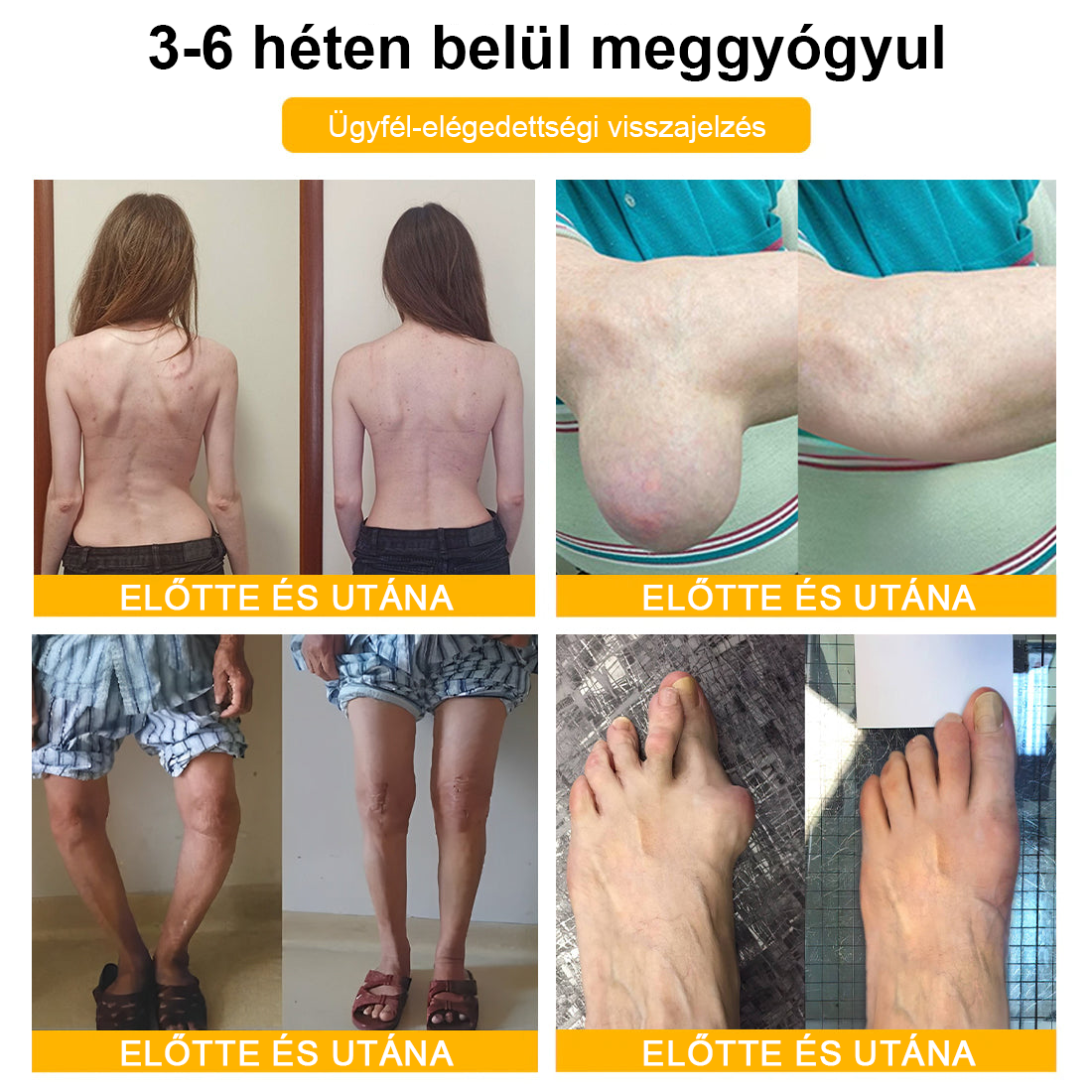 🦴TLOPA® Botulinum Toxin és Méhméreg Fájdalomcsillapító Csontgyógyító Krém🐝 🔥(Kifejezetten időseknek & ortopéd szakorvosok ajánlásával)🦴🦴