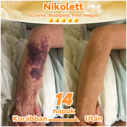 🎁🧡APKAPK®  Méhméreg krém a bőr megújítására 🐝 segít megoldani olyan bőrproblémákat, mint: ráncok, hegek, pigmentfoltok, striák, akné, pikkelysömör, ekcéma, bőrelváltozások, irritációk, gyulladások és egyéb bőrpanaszok.🧡🐝🐝