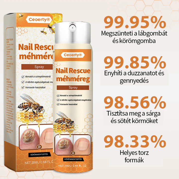 💥 2025 Korlátozott 70% KEDVEZMÉNY ️⏳ Ceoerty® NailRescue Kolirin méhméreg körömgomba spray 💥 Minden körömproblémát orvosolhatsz 2 héten belül👣