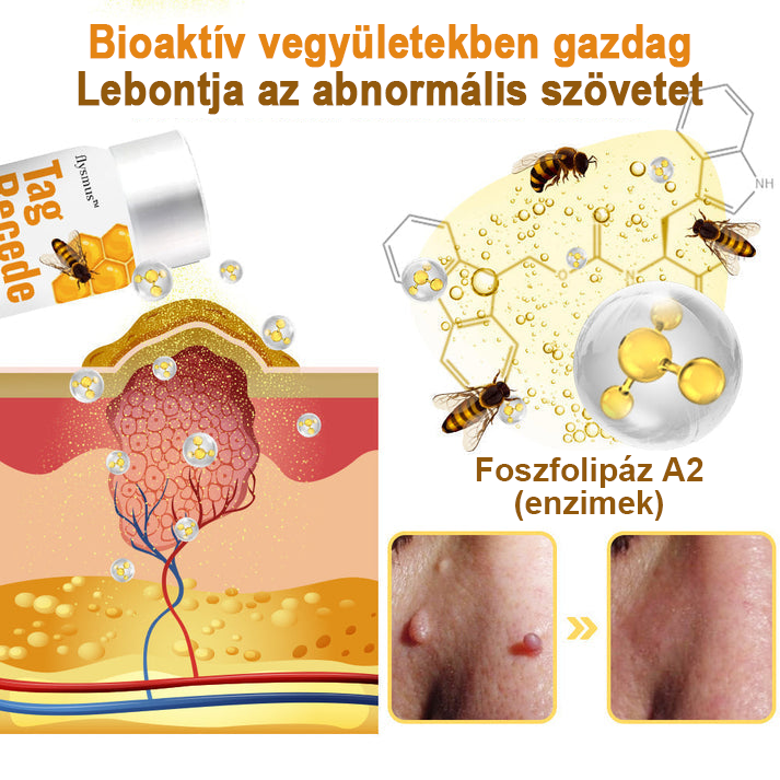 [💗utánvétel (COD)💗] Flysmus™Méhméreg szemölcs és övsömör eltávolító spray (👨‍⚕AAD Ajánlott) 🐝🐝(🔥Last Day 80% Off)🔥🔥🔥🔥