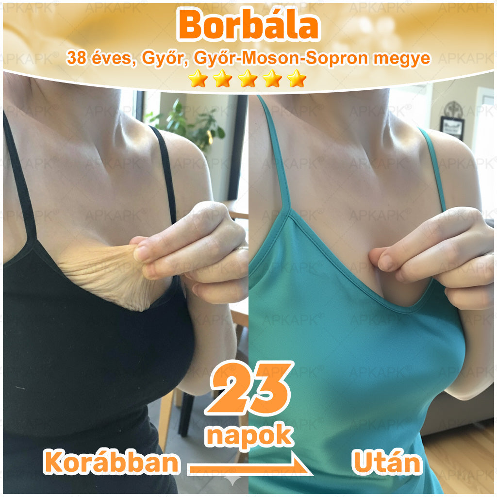 🎁🧡APKAPK®  Méhméreg krém a bőr megújítására 🐝 segít megoldani olyan bőrproblémákat, mint: ráncok, hegek, pigmentfoltok, striák, akné, pikkelysömör, ekcéma, bőrelváltozások, irritációk, gyulladások és egyéb bőrpanaszok.🧡🐝🐝