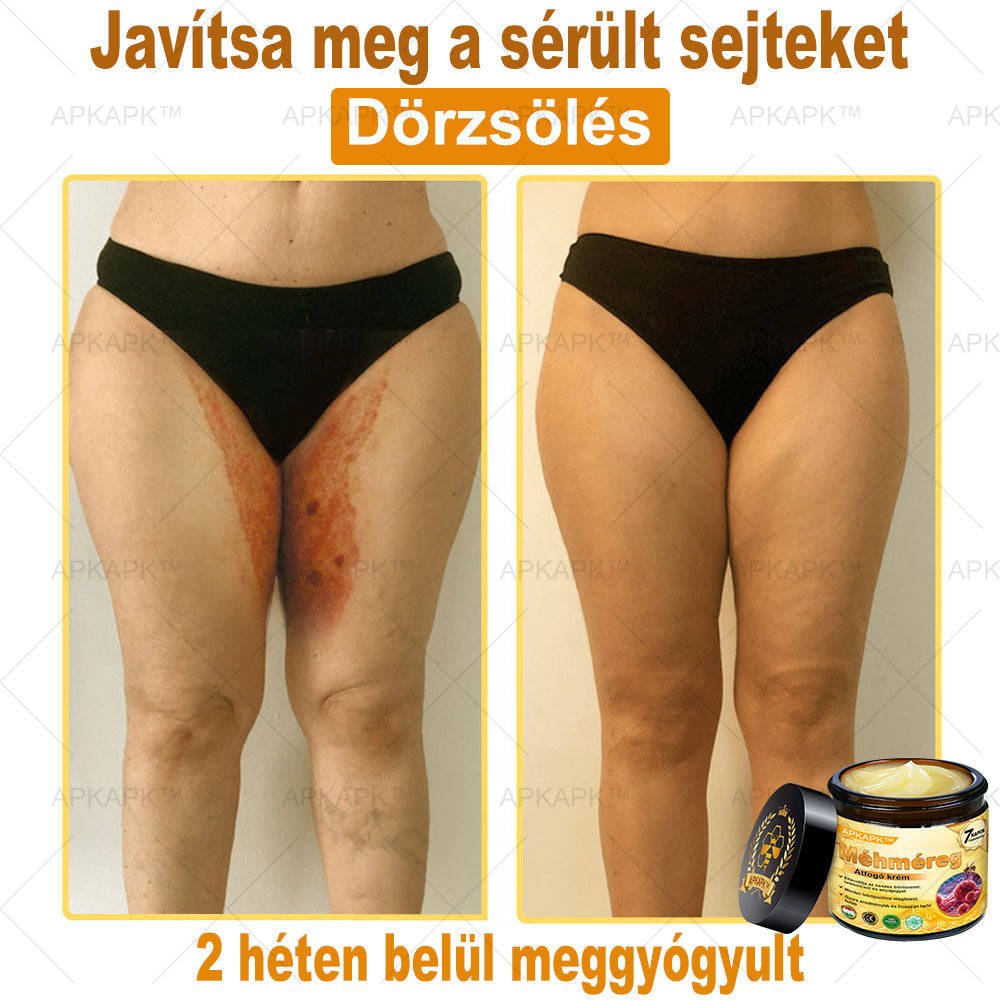 𝐀𝐏𝐊𝐀𝐏𝐊™ 𝐌É𝐇𝐌É𝐑𝐄𝐆 Á𝐓𝐅𝐎𝐆Ó 𝐊𝐑É𝐌🥇🥇𝐀 𝐛ö𝐫𝐩𝐫𝐨𝐛𝐥é𝐦á𝐤 𝐤𝐞𝐳𝐞𝐥é𝐬𝐞 𝐦𝐚𝐠á𝐛𝐚𝐧 𝐟𝐨𝐠𝐥𝐚𝐥𝐣𝐚: é𝐥𝐞𝐭𝐤𝐨𝐫𝐢 𝐟𝐨𝐥𝐭𝐨𝐤, 𝐡𝐞𝐠𝐞𝐤, 𝐬𝐳𝐞𝐦ö𝐥𝐜𝐬ö𝐤, 𝐛ö𝐫𝐧ö𝐯𝐞𝐝é𝐤𝐞𝐤, 𝐭á𝐥𝐲𝐨𝐠𝐨𝐤, 𝐩𝐚𝐭𝐭𝐚𝐧á𝐬𝐨𝐤, 𝐞𝐤𝐜é𝐦𝐚, 𝐩𝐬𝐨𝐫𝐢𝐚𝐬𝐢𝐬, 𝐚𝐜𝐧𝐞 𝐢𝐧𝐯𝐞𝐫𝐬𝐚, 𝐫á𝐧𝐜𝐨𝐤, 𝐛ö𝐫ö𝐫𝐞𝐠𝐞𝐝é𝐬 é𝐬 𝐞𝐠𝐲é𝐛 𝐩𝐫𝐨𝐛𝐥é𝐦á𝐤🔥🔥🔥🔥