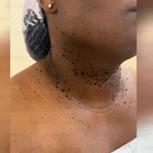 𝐉𝐚𝐬𝐬𝐞𝐞𝐦® Fejlett, nem invazív bőrjavító CO₂ lézeres toll 🛫 (Gyengéden eltávolítja a szemölcsöket, anyajegyeket, öregségi foltokat és bőrkinövéseket – fájdalom és gond nélkül!)🔥🔥