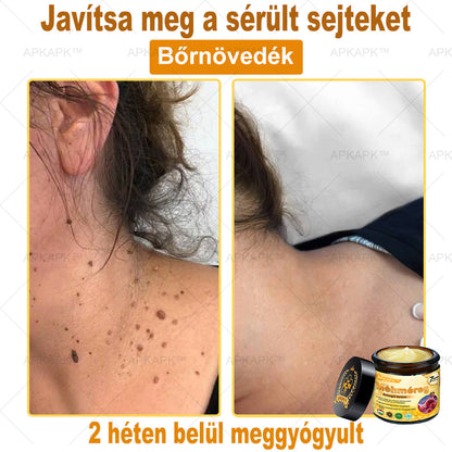 𝐀𝐏𝐊𝐀𝐏𝐊™ 𝐌É𝐇𝐌É𝐑𝐄𝐆 Á𝐓𝐅𝐎𝐆Ó 𝐊𝐑É𝐌🥇🥇𝐀 𝐛ö𝐫𝐩𝐫𝐨𝐛𝐥é𝐦á𝐤 𝐤𝐞𝐳𝐞𝐥é𝐬𝐞 𝐦𝐚𝐠á𝐛𝐚𝐧 𝐟𝐨𝐠𝐥𝐚𝐥𝐣𝐚: é𝐥𝐞𝐭𝐤𝐨𝐫𝐢 𝐟𝐨𝐥𝐭𝐨𝐤, 𝐡𝐞𝐠𝐞𝐤, 𝐬𝐳𝐞𝐦ö𝐥𝐜𝐬ö𝐤, 𝐛ö𝐫𝐧ö𝐯𝐞𝐝é𝐤𝐞𝐤, 𝐭á𝐥𝐲𝐨𝐠𝐨𝐤, 𝐩𝐚𝐭𝐭𝐚𝐧á𝐬𝐨𝐤, 𝐞𝐤𝐜é𝐦𝐚, 𝐩𝐬𝐨𝐫𝐢𝐚𝐬𝐢𝐬, 𝐚𝐜𝐧𝐞 𝐢𝐧𝐯𝐞𝐫𝐬𝐚, 𝐫á𝐧𝐜𝐨𝐤, 𝐛ö𝐫ö𝐫𝐞𝐠𝐞𝐝é𝐬 é𝐬 𝐞𝐠𝐲é𝐛 𝐩𝐫𝐨𝐛𝐥é𝐦á𝐤🔥🔥🔥🔥