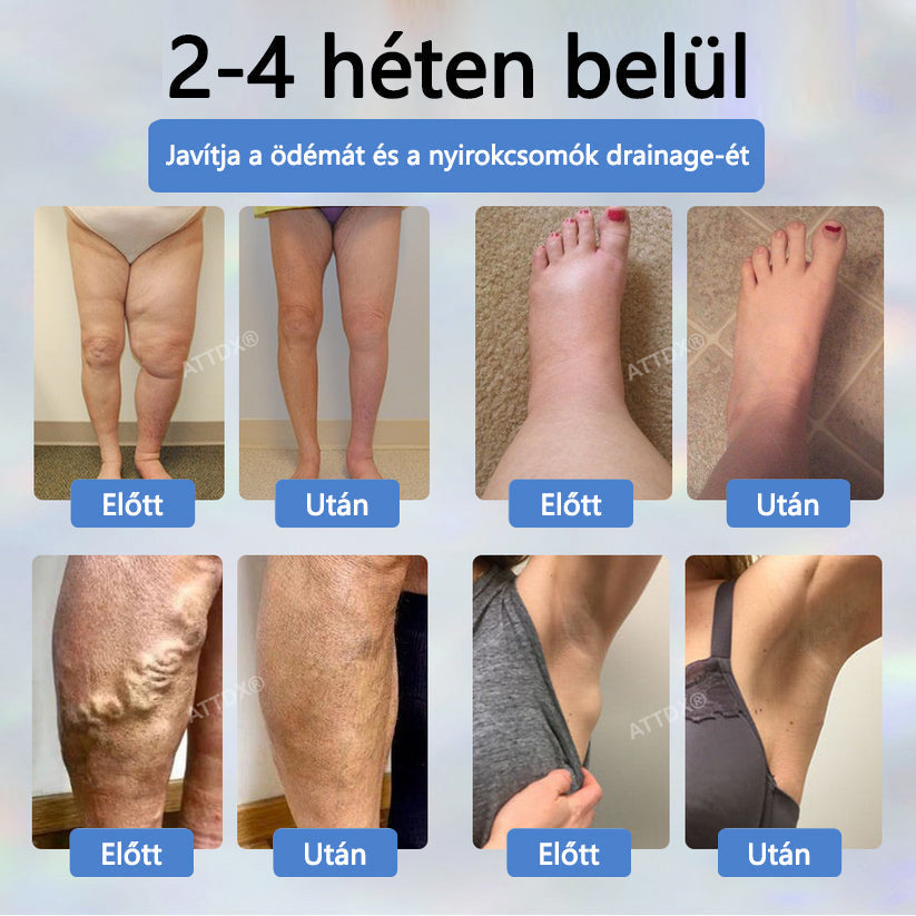 Cvreoz® Fekete kömény Ödéma méregtelenítő gyógynövénykrém - a gyors, látható enyhülés érdekében🍃