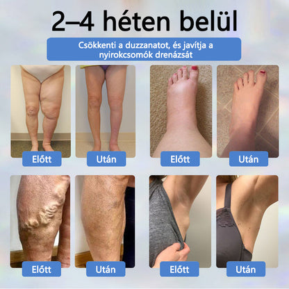 💧ATTDX® Növényi ödéma enyhítő krém nigellával💧💧💧