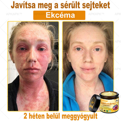 𝐀𝐏𝐊𝐀𝐏𝐊™ 𝐌É𝐇𝐌É𝐑𝐄𝐆 Á𝐓𝐅𝐎𝐆Ó 𝐊𝐑É𝐌🥇🥇𝐀 𝐛ö𝐫𝐩𝐫𝐨𝐛𝐥é𝐦á𝐤 𝐤𝐞𝐳𝐞𝐥é𝐬𝐞 𝐦𝐚𝐠á𝐛𝐚𝐧 𝐟𝐨𝐠𝐥𝐚𝐥𝐣𝐚: é𝐥𝐞𝐭𝐤𝐨𝐫𝐢 𝐟𝐨𝐥𝐭𝐨𝐤, 𝐡𝐞𝐠𝐞𝐤, 𝐬𝐳𝐞𝐦ö𝐥𝐜𝐬ö𝐤, 𝐛ö𝐫𝐧ö𝐯𝐞𝐝é𝐤𝐞𝐤, 𝐭á𝐥𝐲𝐨𝐠𝐨𝐤, 𝐩𝐚𝐭𝐭𝐚𝐧á𝐬𝐨𝐤, 𝐞𝐤𝐜é𝐦𝐚, 𝐩𝐬𝐨𝐫𝐢𝐚𝐬𝐢𝐬, 𝐚𝐜𝐧𝐞 𝐢𝐧𝐯𝐞𝐫𝐬𝐚, 𝐫á𝐧𝐜𝐨𝐤, 𝐛ö𝐫ö𝐫𝐞𝐠𝐞𝐝é𝐬 é𝐬 𝐞𝐠𝐲é𝐛 𝐩𝐫𝐨𝐛𝐥é𝐦á𝐤🔥🔥🔥🔥