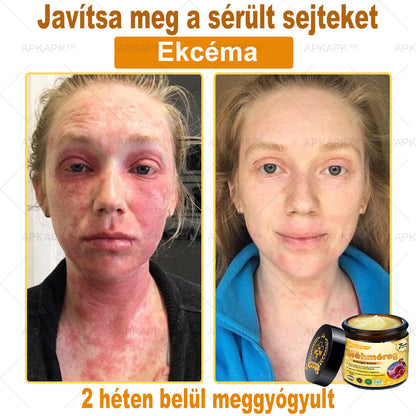 🎁🧡APKAPK®  Méhméreg krém a bőr megújítására 🐝 segít megoldani olyan bőrproblémákat, mint: ráncok, hegek, pigmentfoltok, striák, akné, pikkelysömör, ekcéma, bőrelváltozások, irritációk, gyulladások és egyéb bőrpanaszok.🧡🐝🐝