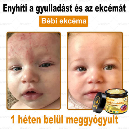 🎁🧡APKAPK®  Méhméreg krém a bőr megújítására 🐝 segít megoldani olyan bőrproblémákat, mint: ráncok, hegek, pigmentfoltok, striák, akné, pikkelysömör, ekcéma, bőrelváltozások, irritációk, gyulladások és egyéb bőrpanaszok.🧡🐝🐝