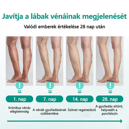 Cvreoz® LegRenew visszér tapasz javítja a vénák egészségét és megszünteti a visszereket🌿Nincs tű, nincs műtét, csak biztonságos, gyengéd és hatékony eredmény✨✨✨✨
