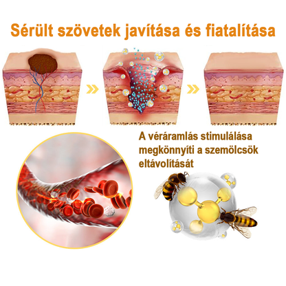 [💗utánvétel (COD)💗] Flysmus™Méhméreg szemölcs és övsömör eltávolító spray (👨‍⚕AAD Ajánlott) 🐝🐝(🔥Last Day 80% Off)🔥🔥🔥🔥