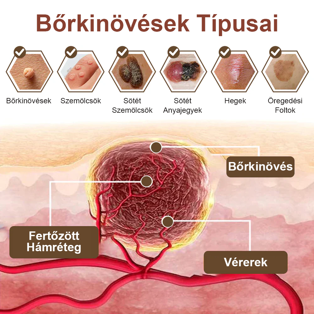 ✅ Pureluxo® Fekete Rizses Bőrregeneráló Krém 👨‍⚕️ (Szemölcsök, bőrkinövések, foltok és hiperpigmentáció kezelésére)✅✅✅