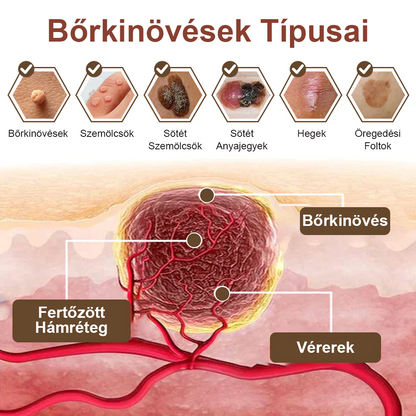 ✅ Pureluxo® Fekete Rizses Bőrregeneráló Krém 👨‍⚕️ (Szemölcsök, bőrkinövések, foltok és hiperpigmentáció kezelésére)✅✅✅