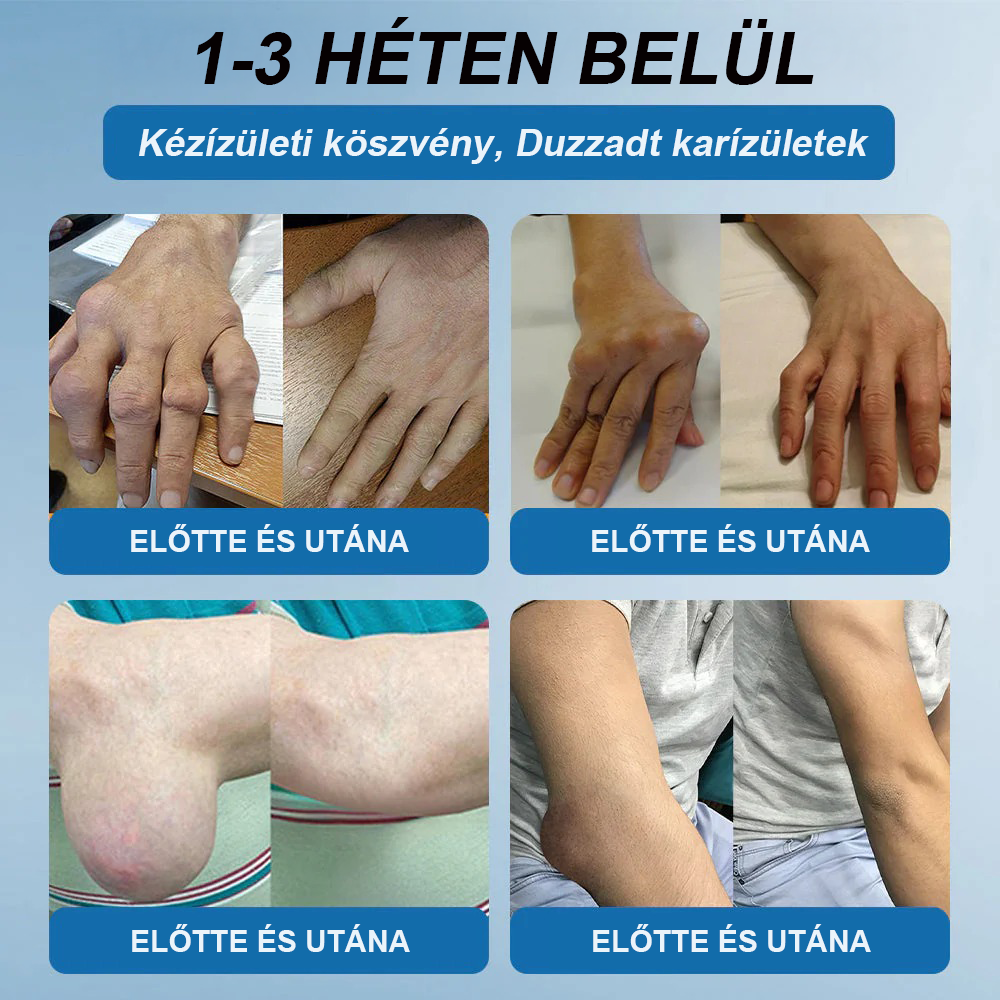 𝖯𝗂𝖼𝗱𝗼® BPC-157 Ízületi Gyógyító Krém🦴Ízületi gyulladás, neuropátia, reuma, sportsérülések és egyebek kezelésére🦵🦵🦵🦵