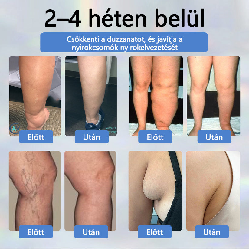 💧ATTDX® Növényi ödéma enyhítő krém nigellával💧💧💧