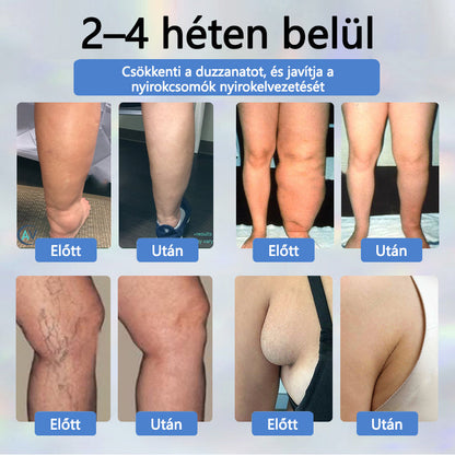 💧ATTDX® Növényi ödéma enyhítő krém nigellával💧💧💧