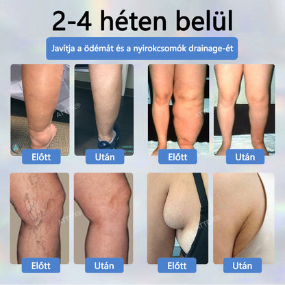 Cvreoz® Fekete kömény Ödéma méregtelenítő gyógynövénykrém - a gyors, látható enyhülés érdekében🍃