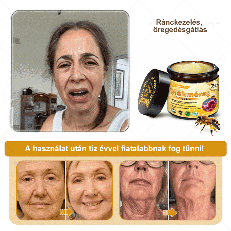 𝐀𝐏𝐊𝐀𝐏𝐊™ 𝐌É𝐇𝐌É𝐑𝐄𝐆 Á𝐓𝐅𝐎𝐆Ó 𝐊𝐑É𝐌🥇🥇𝐀 𝐛ö𝐫𝐩𝐫𝐨𝐛𝐥é𝐦á𝐤 𝐤𝐞𝐳𝐞𝐥é𝐬𝐞 𝐦𝐚𝐠á𝐛𝐚𝐧 𝐟𝐨𝐠𝐥𝐚𝐥𝐣𝐚: é𝐥𝐞𝐭𝐤𝐨𝐫𝐢 𝐟𝐨𝐥𝐭𝐨𝐤, 𝐡𝐞𝐠𝐞𝐤, 𝐬𝐳𝐞𝐦ö𝐥𝐜𝐬ö𝐤, 𝐛ö𝐫𝐧ö𝐯𝐞𝐝é𝐤𝐞𝐤, 𝐭á𝐥𝐲𝐨𝐠𝐨𝐤, 𝐩𝐚𝐭𝐭𝐚𝐧á𝐬𝐨𝐤, 𝐞𝐤𝐜é𝐦𝐚, 𝐩𝐬𝐨𝐫𝐢𝐚𝐬𝐢𝐬, 𝐚𝐜𝐧𝐞 𝐢𝐧𝐯𝐞𝐫𝐬𝐚, 𝐫á𝐧𝐜𝐨𝐤, 𝐛ö𝐫ö𝐫𝐞𝐠𝐞𝐝é𝐬 é𝐬 𝐞𝐠𝐲é𝐛 𝐩𝐫𝐨𝐛𝐥é𝐦á𝐤🔥🔥🔥🔥