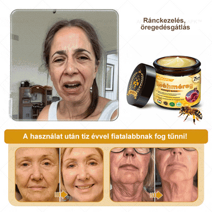 🎁🧡APKAPK®  Méhméreg krém a bőr megújítására 🐝 segít megoldani olyan bőrproblémákat, mint: ráncok, hegek, pigmentfoltok, striák, akné, pikkelysömör, ekcéma, bőrelváltozások, irritációk, gyulladások és egyéb bőrpanaszok.🧡🐝🐝