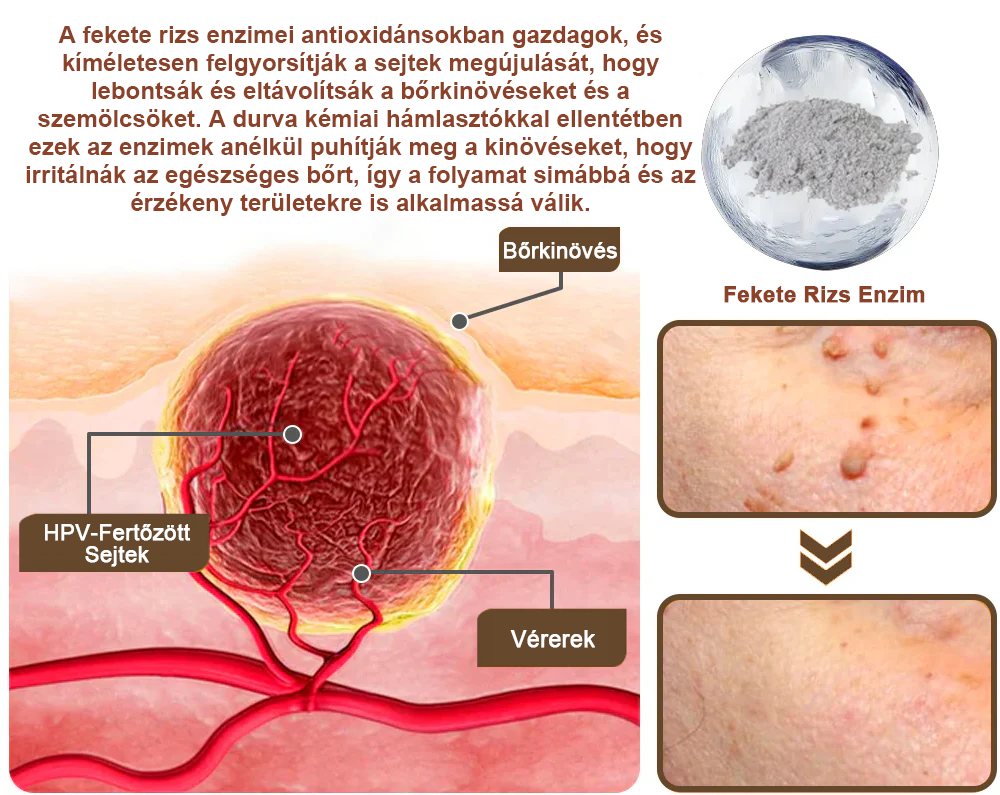 ✅ Pureluxo® Fekete Rizses Bőrregeneráló Krém 👨‍⚕️ (Szemölcsök, bőrkinövések, foltok és hiperpigmentáció kezelésére)✅✅✅
