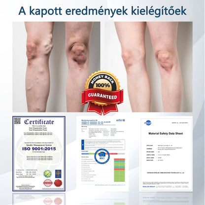 💧ATTDX® Növényi ödéma enyhítő krém nigellával💧💧💧