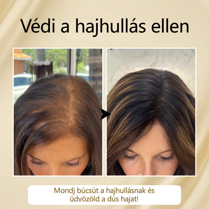 Timilk® VitaStrand Biotin hajnövekedést elősegítő spray✅ Sűrű, fényes haj néhány hét alatt🔥
