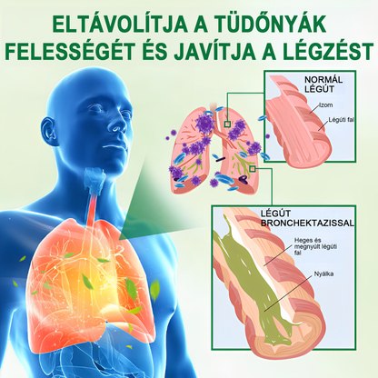☘️[Hivatalos márkaüzlet] 👨‍⚕️𝐌𝐈𝐐𝐈𝐊𝐎® Fejlett tüdőtisztító spray (☘️Tüdőspecialisták ajánlásával)☘️☘️☘️