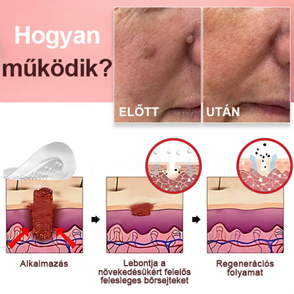 KUBOZN® Nano-mikrotűs bőrcímke-eltávolító tapaszok✨✨