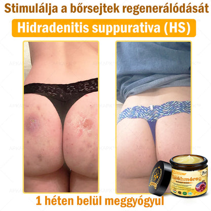 𝐀𝐏𝐊𝐀𝐏𝐊™ 𝐌É𝐇𝐌É𝐑𝐄𝐆 Á𝐓𝐅𝐎𝐆Ó 𝐊𝐑É𝐌🥇🥇𝐀 𝐛ö𝐫𝐩𝐫𝐨𝐛𝐥é𝐦á𝐤 𝐤𝐞𝐳𝐞𝐥é𝐬𝐞 𝐦𝐚𝐠á𝐛𝐚𝐧 𝐟𝐨𝐠𝐥𝐚𝐥𝐣𝐚: é𝐥𝐞𝐭𝐤𝐨𝐫𝐢 𝐟𝐨𝐥𝐭𝐨𝐤, 𝐡𝐞𝐠𝐞𝐤, 𝐬𝐳𝐞𝐦ö𝐥𝐜𝐬ö𝐤, 𝐛ö𝐫𝐧ö𝐯𝐞𝐝é𝐤𝐞𝐤, 𝐭á𝐥𝐲𝐨𝐠𝐨𝐤, 𝐩𝐚𝐭𝐭𝐚𝐧á𝐬𝐨𝐤, 𝐞𝐤𝐜é𝐦𝐚, 𝐩𝐬𝐨𝐫𝐢𝐚𝐬𝐢𝐬, 𝐚𝐜𝐧𝐞 𝐢𝐧𝐯𝐞𝐫𝐬𝐚, 𝐫á𝐧𝐜𝐨𝐤, 𝐛ö𝐫ö𝐫𝐞𝐠𝐞𝐝é𝐬 é𝐬 𝐞𝐠𝐲é𝐛 𝐩𝐫𝐨𝐛𝐥é𝐦á𝐤🔥🔥🔥🔥