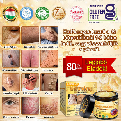 𝐀𝐏𝐊𝐀𝐏𝐊™ 𝐌É𝐇𝐌É𝐑𝐄𝐆 Á𝐓𝐅𝐎𝐆Ó 𝐊𝐑É𝐌🥇🥇𝐀 𝐛ö𝐫𝐩𝐫𝐨𝐛𝐥é𝐦á𝐤 𝐤𝐞𝐳𝐞𝐥é𝐬𝐞 𝐦𝐚𝐠á𝐛𝐚𝐧 𝐟𝐨𝐠𝐥𝐚𝐥𝐣𝐚: é𝐥𝐞𝐭𝐤𝐨𝐫𝐢 𝐟𝐨𝐥𝐭𝐨𝐤, 𝐡𝐞𝐠𝐞𝐤, 𝐬𝐳𝐞𝐦ö𝐥𝐜𝐬ö𝐤, 𝐛ö𝐫𝐧ö𝐯𝐞𝐝é𝐤𝐞𝐤, 𝐭á𝐥𝐲𝐨𝐠𝐨𝐤, 𝐩𝐚𝐭𝐭𝐚𝐧á𝐬𝐨𝐤, 𝐞𝐤𝐜é𝐦𝐚, 𝐩𝐬𝐨𝐫𝐢𝐚𝐬𝐢𝐬, 𝐚𝐜𝐧𝐞 𝐢𝐧𝐯𝐞𝐫𝐬𝐚, 𝐫á𝐧𝐜𝐨𝐤, 𝐛ö𝐫ö𝐫𝐞𝐠𝐞𝐝é𝐬 é𝐬 𝐞𝐠𝐲é𝐛 𝐩𝐫𝐨𝐛𝐥é𝐦á𝐤🔥🔥🔥🔥