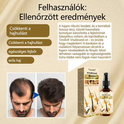 Timilk® VitaStrand Biotin hajnövekedést elősegítő spray✅ Sűrű, fényes haj néhány hét alatt🔥