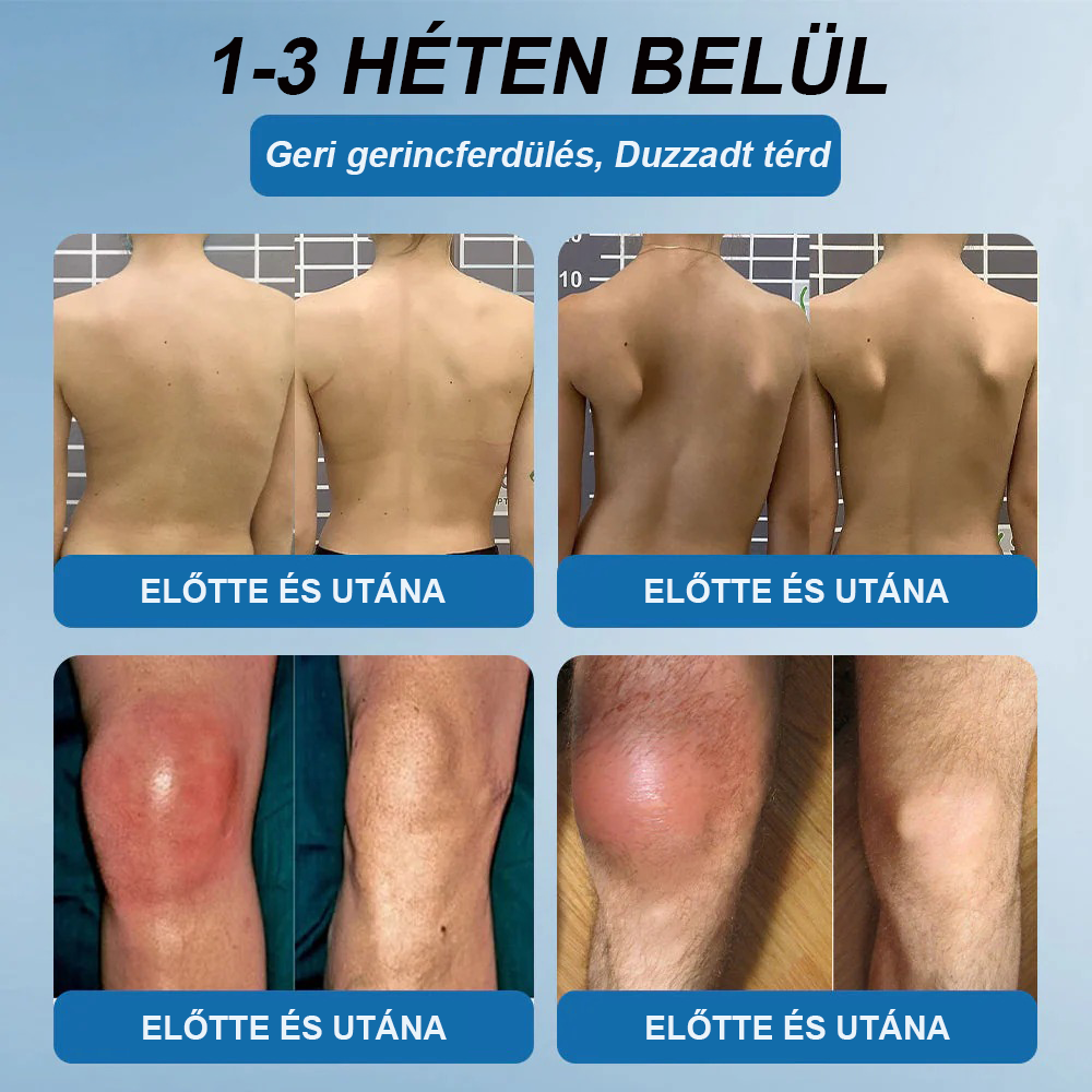 𝖯𝗂𝖼𝗱𝗼® BPC-157 Ízületi Gyógyító Krém🦴Ízületi gyulladás, neuropátia, reuma, sportsérülések és egyebek kezelésére🦵🦵🦵🦵