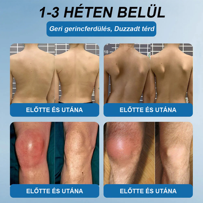 𝖯𝗂𝖼𝗱𝗼® BPC-157 Ízületi Gyógyító Krém🦴Ízületi gyulladás, neuropátia, reuma, sportsérülések és egyebek kezelésére🦵🦵🦵🦵