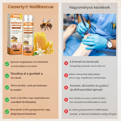 💥 2025 Korlátozott 70% KEDVEZMÉNY ️⏳ Ceoerty® NailRescue Kolirin méhméreg körömgomba spray 💥 Minden körömproblémát orvosolhatsz 2 héten belül👣