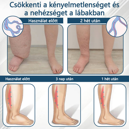 Cvreoz® Fekete kömény Ödéma méregtelenítő gyógynövénykrém - a gyors, látható enyhülés érdekében🍃
