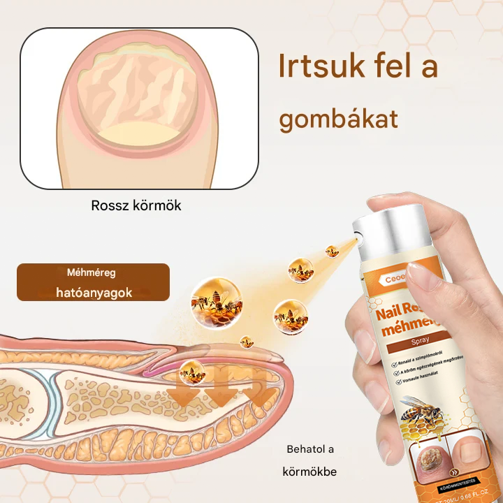 💥 2025 Korlátozott 70% KEDVEZMÉNY ️⏳ Ceoerty® NailRescue Kolirin méhméreg körömgomba spray 💥 Minden körömproblémát orvosolhatsz 2 héten belül👣