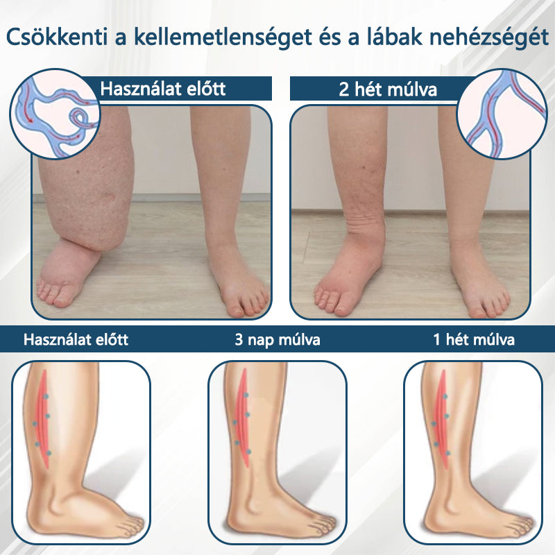 💧ATTDX® Növényi ödéma enyhítő krém nigellával💧💧💧