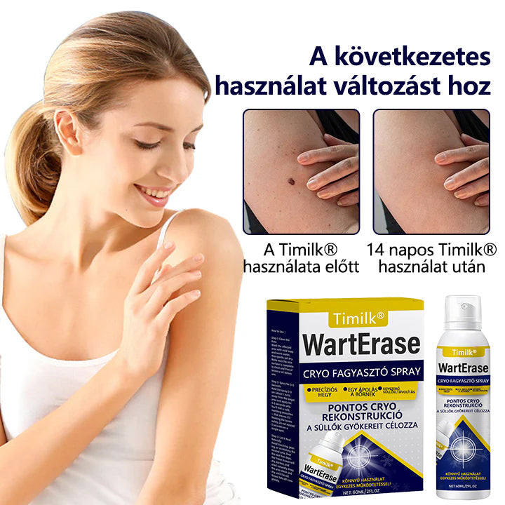 Timilk® WartErase – Fagyasztó Szemölcseltávolító Spray❄️❄️❄️